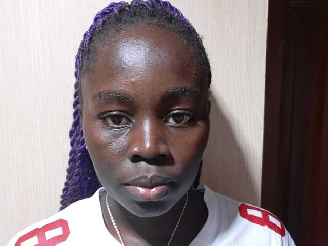 Photo of the profile cilialim