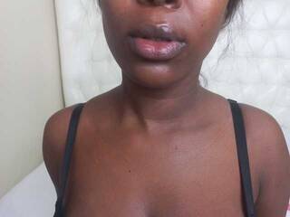 Erotic video chat Freakynessa