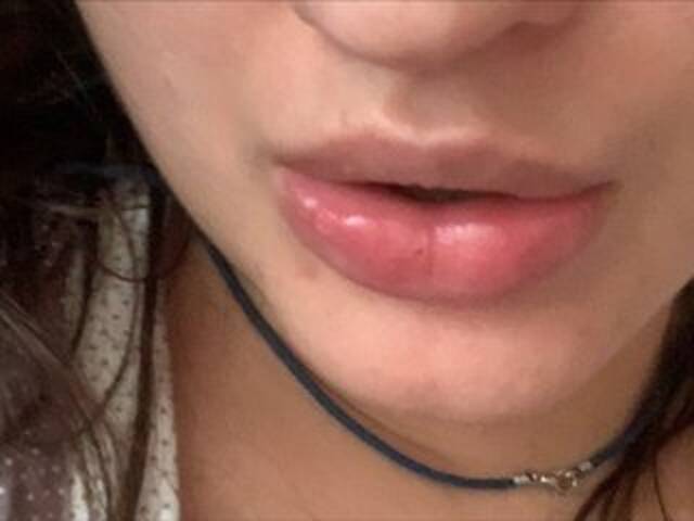 Broadcast screenshots Rinaru555555